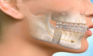 Oral and Maxillofacial Surgery