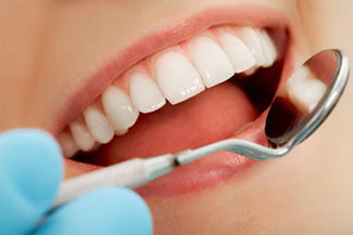 Tooth Whitening