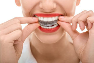 Orthodontic Treatment of Plaque