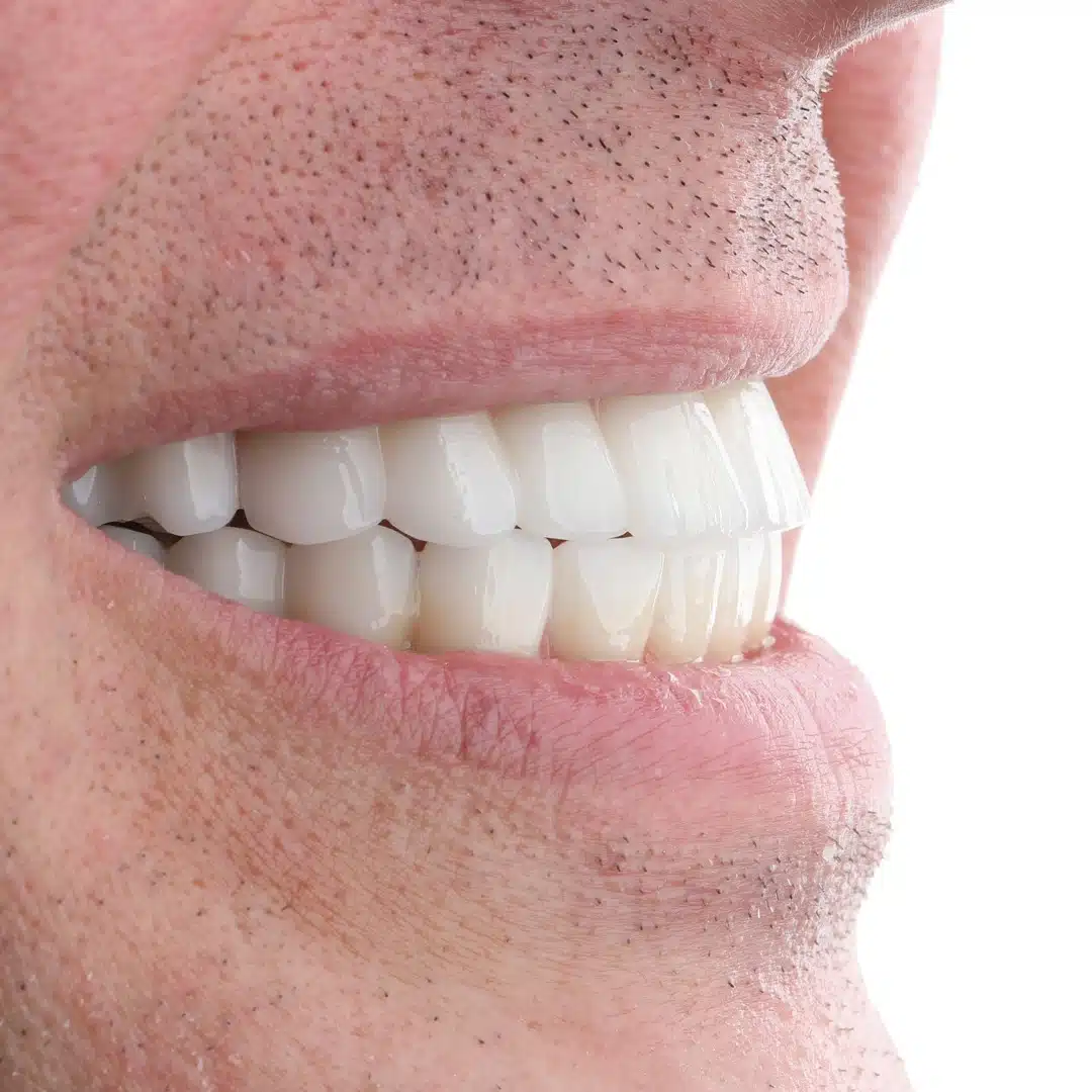 Pre-surgical oral surgery consultation at Bergedent Istanbul